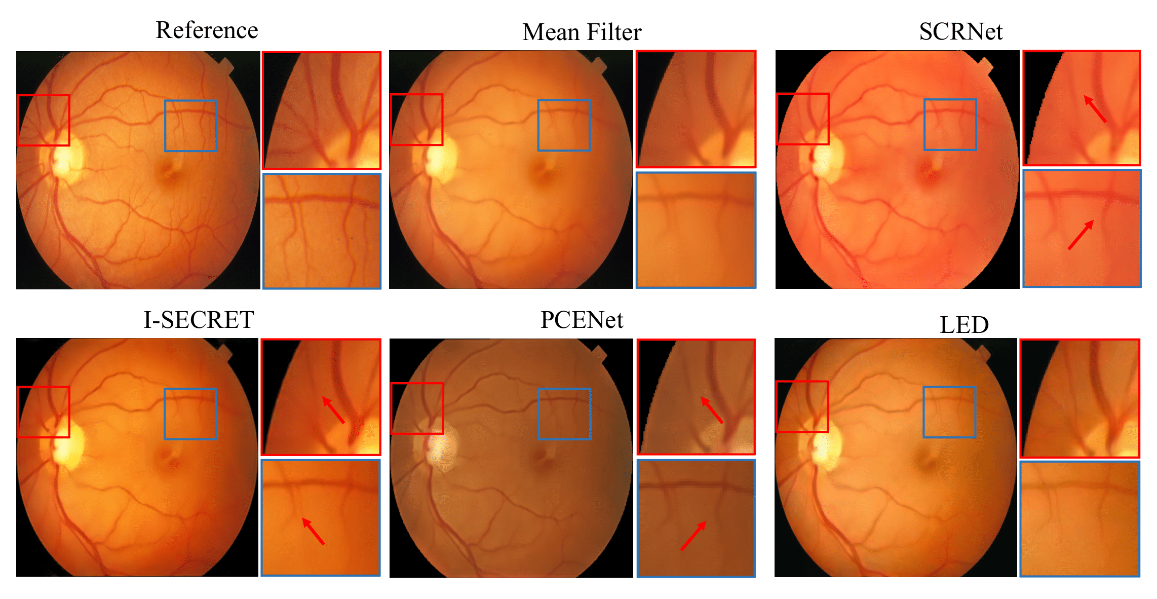 mf_loss.png