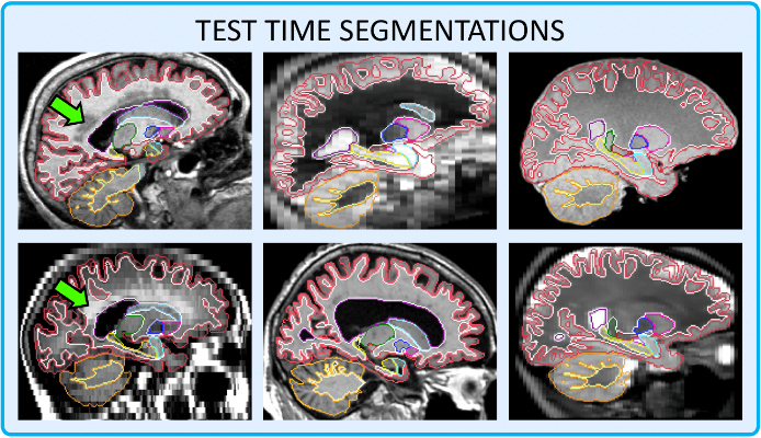 segmentations.png