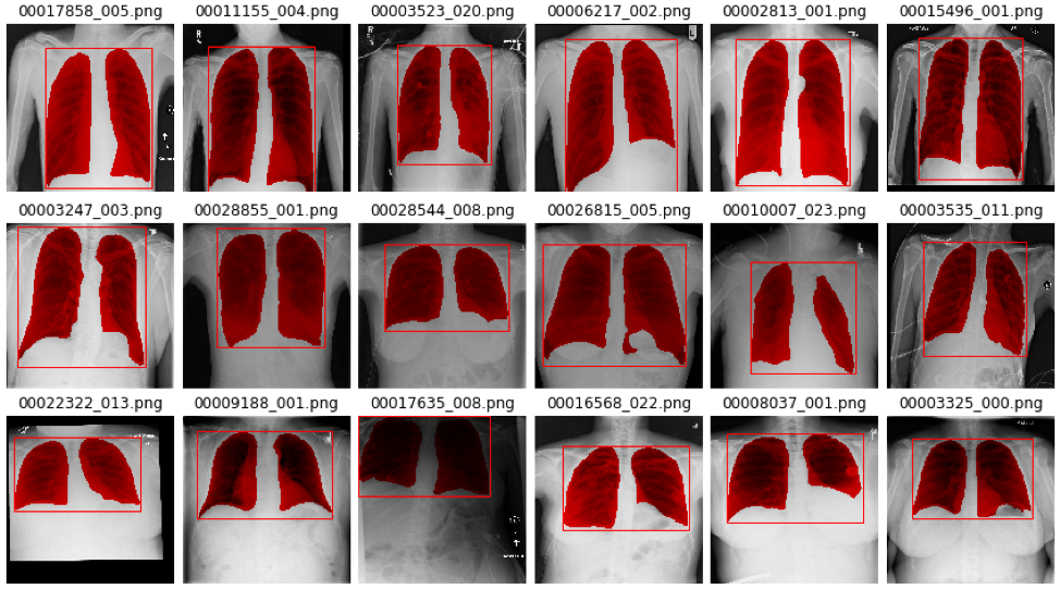 result_cxr14.png