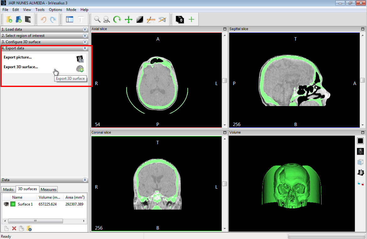 Export STL