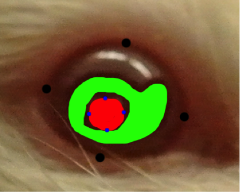 shaded_cataract.png